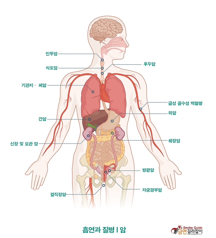 흡연과 질병, 흡연과 암